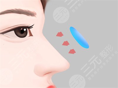 张明利