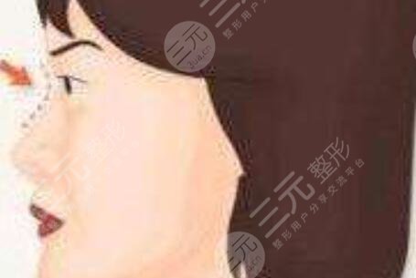 祁佐良