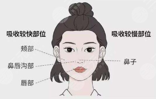 北京301医院脂肪填充怎么样
