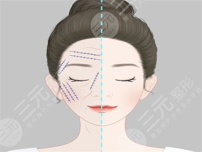 北医三院美容科医生信息