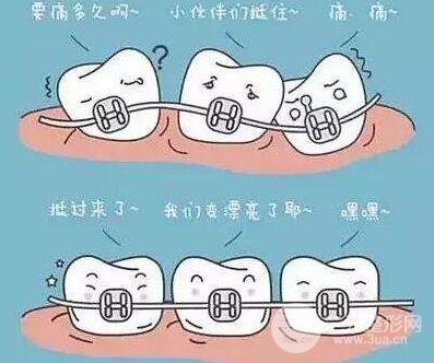 牙齿矫正