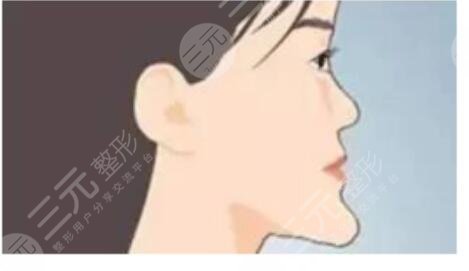 郑大一附院整形科价目表2017一览