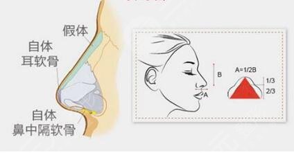上海伊莱美鼻部手术果