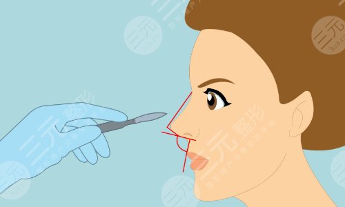 上海时光整形外科医院擅长项目科普