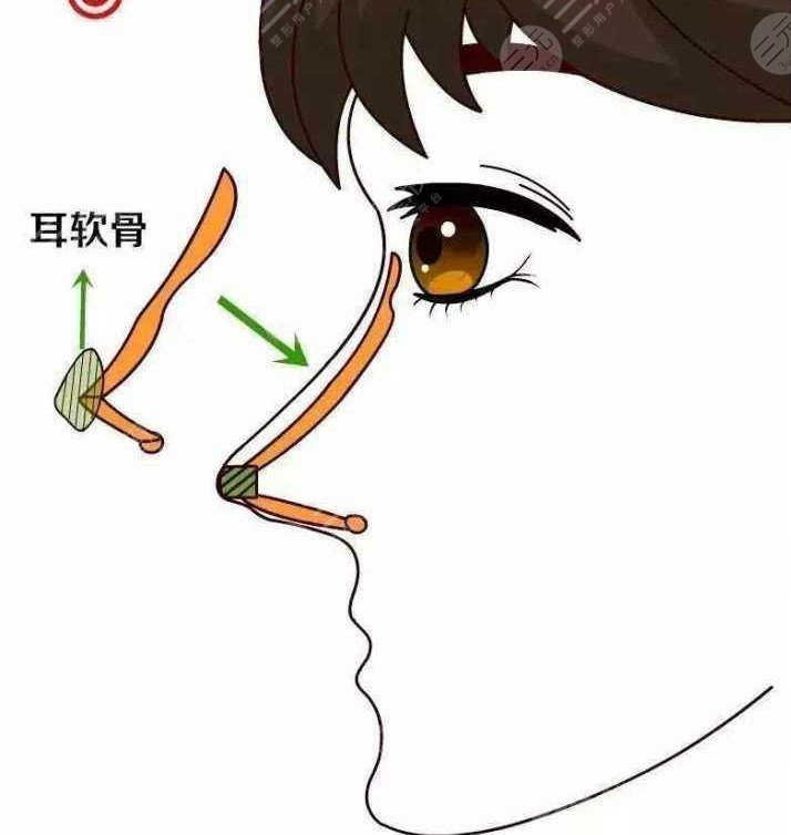 罗飞彪