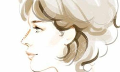 北京加减美黄寅守隆鼻术后4天