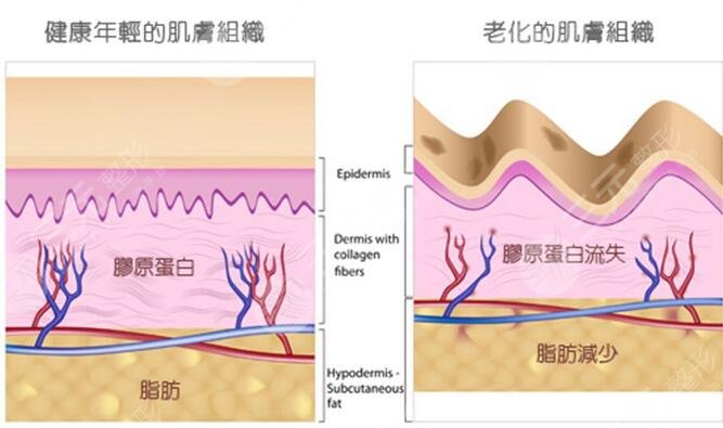 溪峰聚美仕整形怎么样
