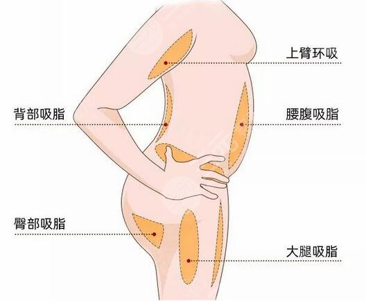 上海丽质形体整形医院怎么样