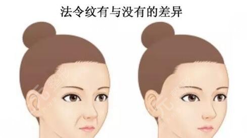 北京八大处面部脂肪填充项目案例体验反馈：