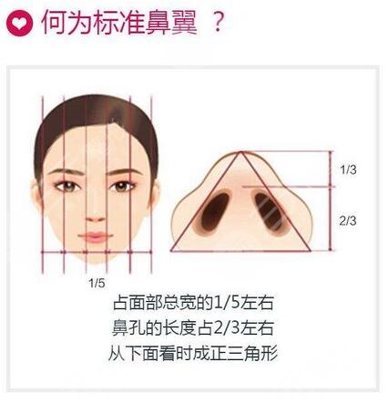 北京美丽嘉医疗隆鼻案例