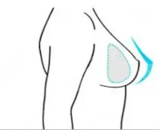 杨跃