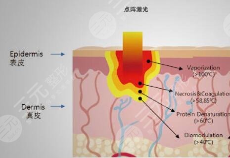 九院点阵激光美容项目案例体验反馈：