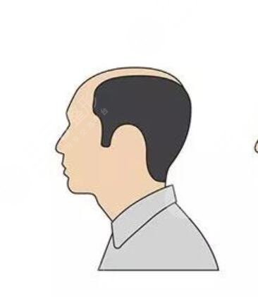 北京艺星植发怎么样