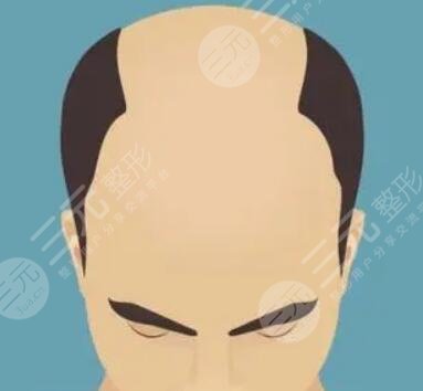 成都丝缘毛发医院怎么样