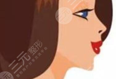 徐医附院整形美容中心双眼皮案例