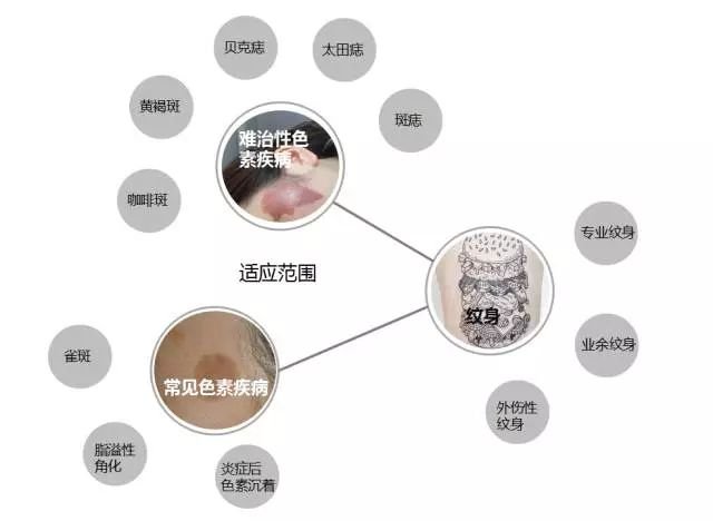 杭州第三人民医院激光美容怎么样