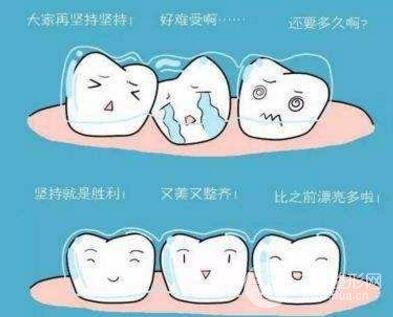 牙齿矫正