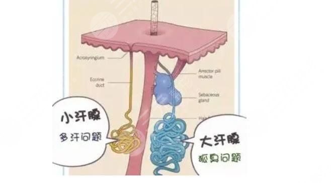 体臭和狐臭的区别是什么呢？一招教你如何避免夏季尴尬！