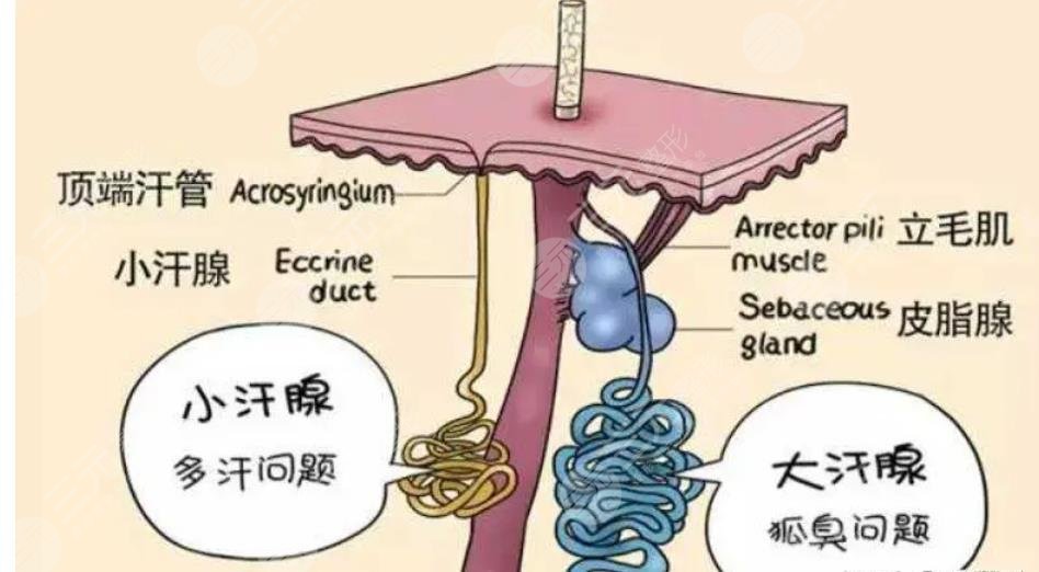 体臭和狐臭的区别是什么呢？一招教你如何避免夏季尴尬！