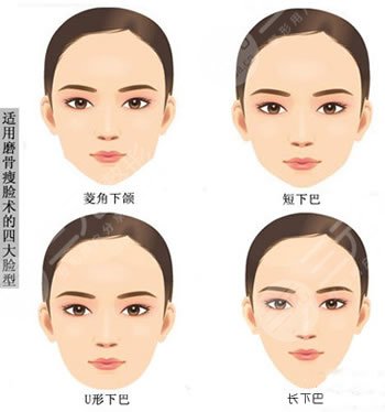 脸部磨骨手术有什么后遗症?