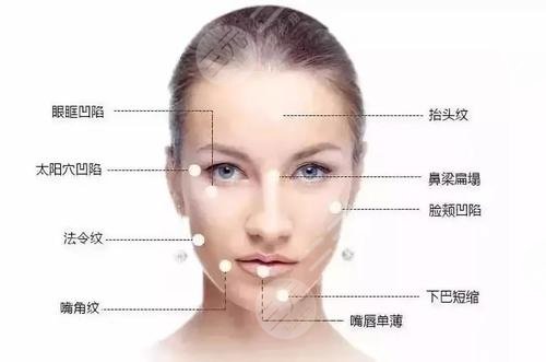 玻尿酸的作用与功效有哪些?多少钱一针?附全新价格+注意事项!