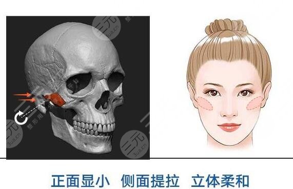 磨颧骨的注意事项