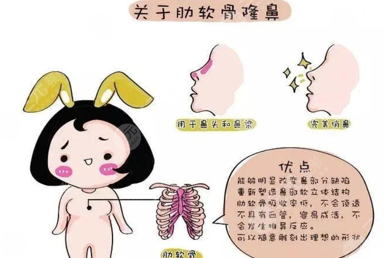 做鼻子做假体好还是肋骨鼻好