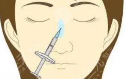 玻尿酸填充鼻子能维持多久?