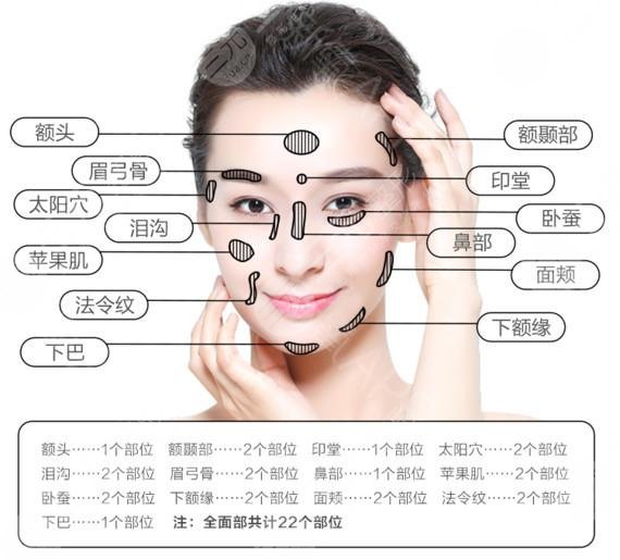 面部凹陷用什么填充好？假体、自体脂肪等都很受欢迎！
