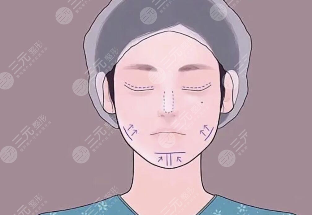 膨体和硅胶的区别哪个更好更安全