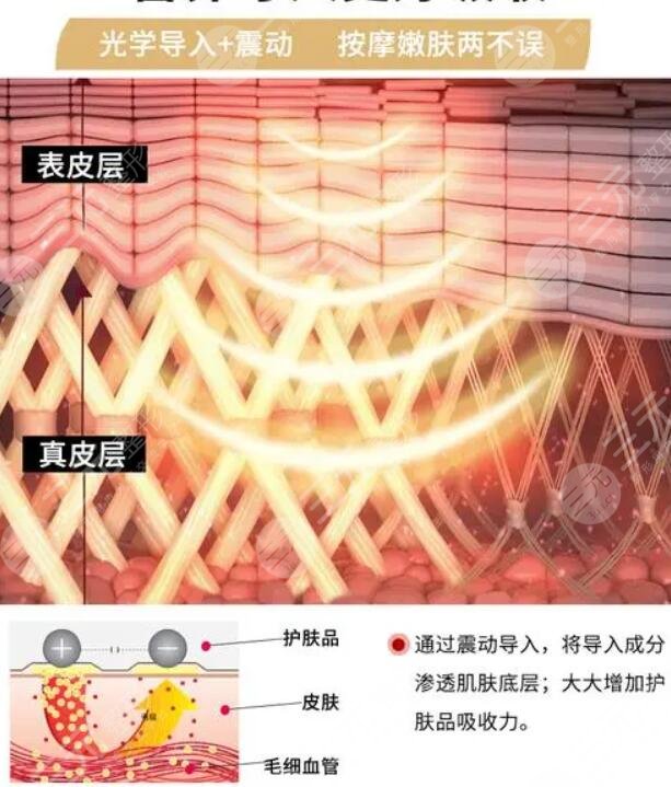 冰电波除皱怎么样？