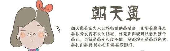 朝天鼻纠正整形手术费用多少钱？