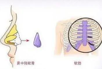 肋骨优势解读