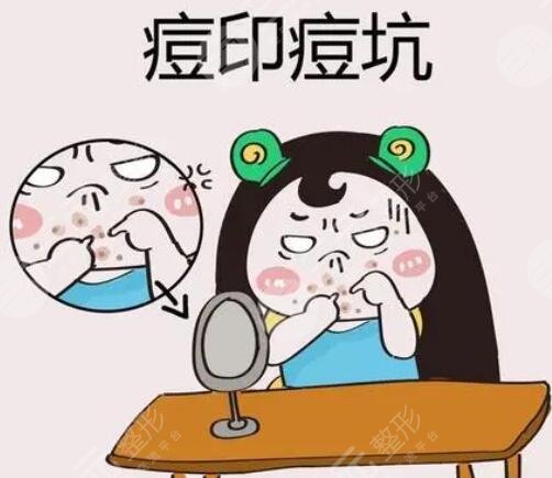 脸上长痘痘怎么去除
