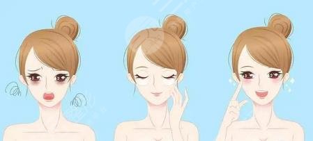 超声波去眼袋效果