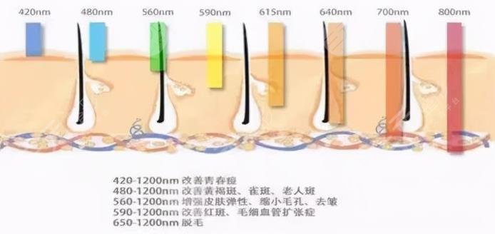 激光美白价格高吗?