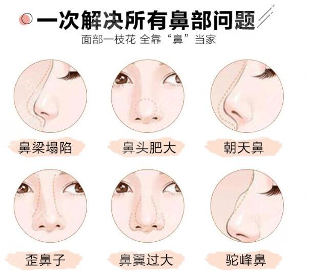 韩式三段隆鼻手术后应该注意什么呢?