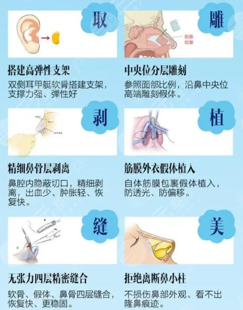 为什么韩式三段隆鼻不推荐做?