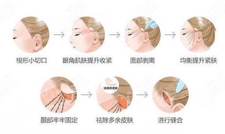 怎样消除皱纹?3个热门小妙招分享