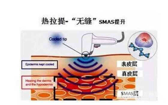 热拉提和热玛吉的深度区别