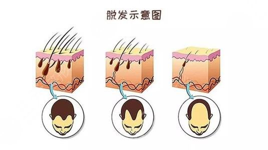 导致头发生长缓慢的原因有哪些?