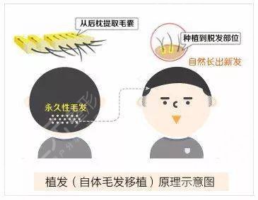 促进头发生长的方法有哪些?