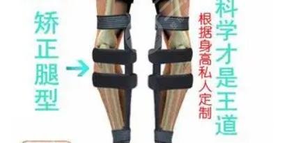 o型腿怎么矫正