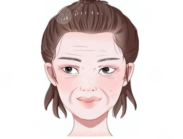 7d聚拉提效果维持多久?效果怎么样?知识点都在这篇了,看完拒做“大冤种”