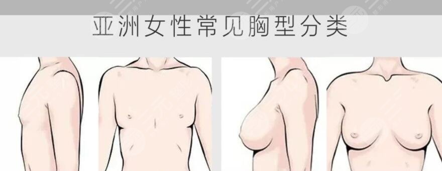 双平面隆胸手术之前需要做好哪些准备工作?