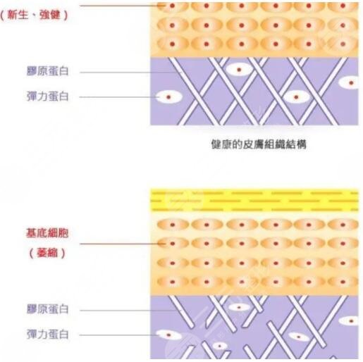 赛诺秀5D胶原光和赛诺龙5Gmax极速提拉效果一样吗？