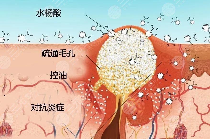 水杨酸的作用和危害