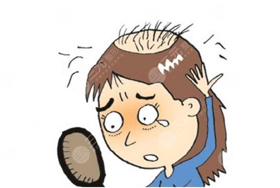 植发2000单位有多大面积?大概要多少个毛囊和钱?附收费价格表+手术科普