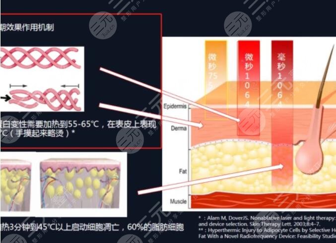 赛诺秀5d胶原光的术前注意事项