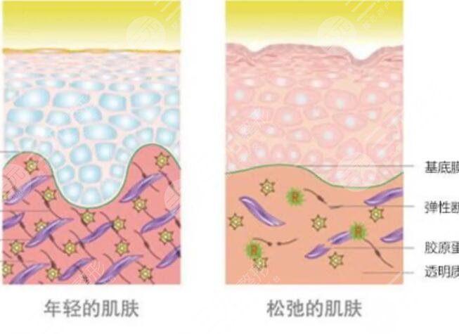 赛诺秀5d胶原光的术后注意事项：